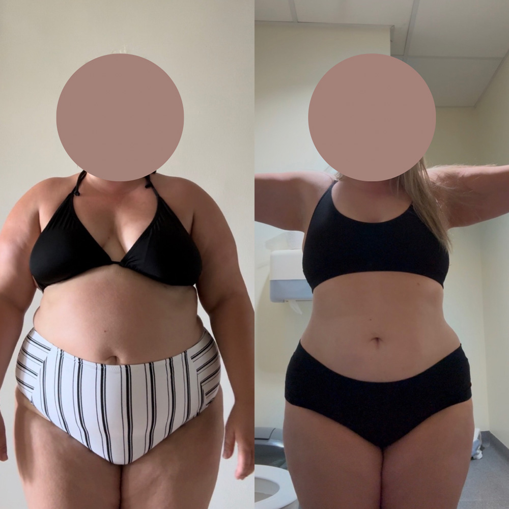 Transformation 6